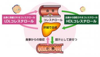 悪玉コレステロール値が上限値を超えていた