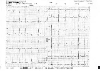 ファイル名: 20130511-1.jpg
ファイルサイズ: 134.5KB
→クリックで元のサイズを表示 心電図の検査結果は異常なし!