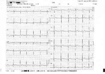心電図の検査結果は異常なし！