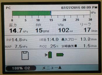 ファイル名: 20150727-02.jpg
ファイルサイズ: 104.5KB
→クリックで元のサイズを表示 人工呼吸器
